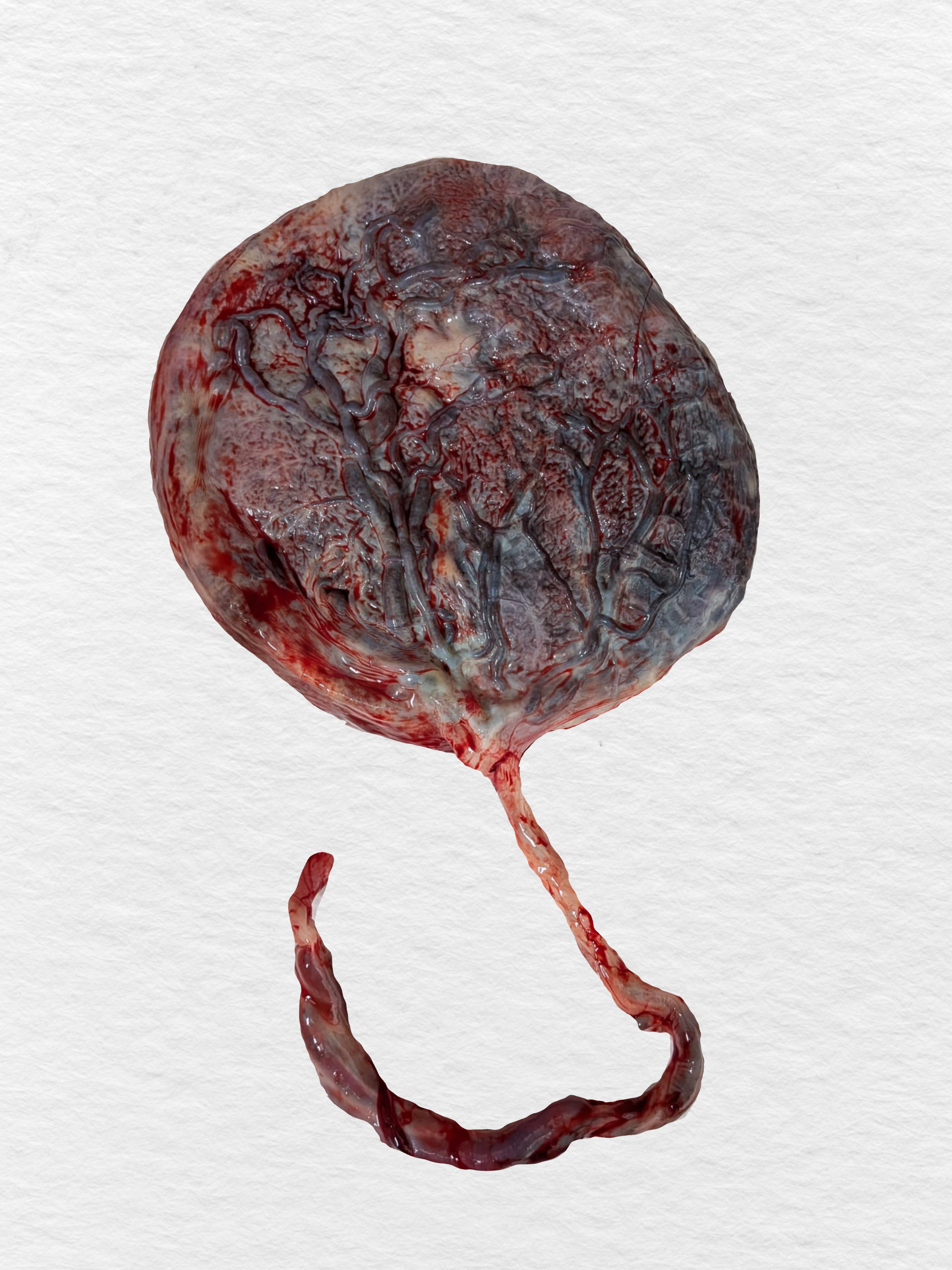 Impresión de placenta Ilustración de placenta a partir de una foto Placenta Print Placenta Ilustration from a photo - PRINT OF LIFE